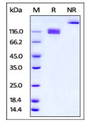 Mouse M-CSF R, Fc Tag on SDS-PAGE under reducing (R) and non-reducing (NR) conditions. The gel was stained overnight with Coomassie Blue. The purity of the protein is greater than 95%.